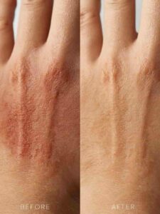 before after oat oil for sensitive skin